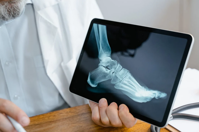 How to Keep Your Bones Strong: Essential Tips for Maintaining Bone Health